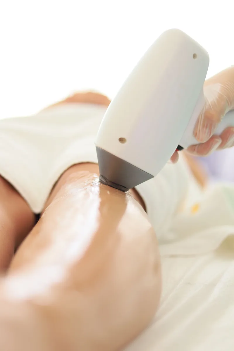 Key West Laser Hair Removal in Key West