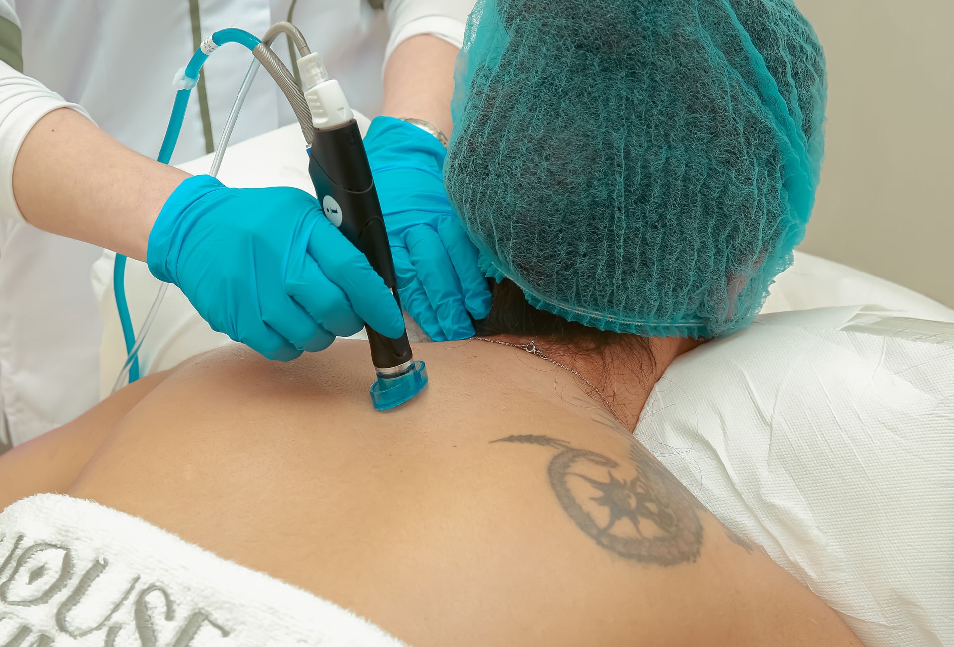 Key West Tattoo Removal in Key West